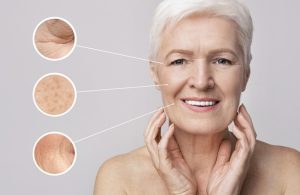 Facial for aging in Myrtle Beach SC