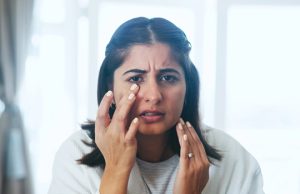 Facials for acne in Myrtle Beach SC