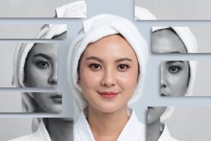 Facials for acne in Myrtle Beach SC